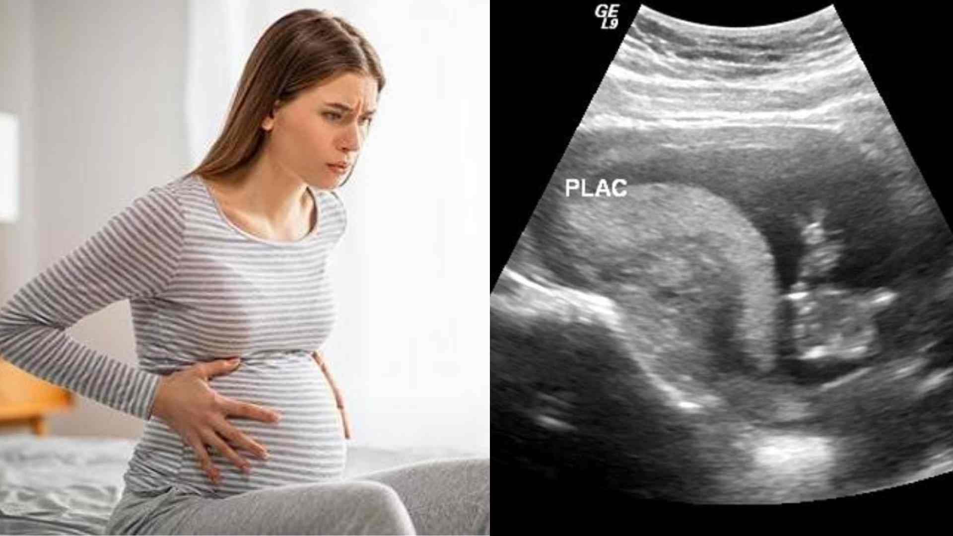 Braxton Hicks Contractions: Care Instructions, How to Prepare for Labour - braxton hicks contractions