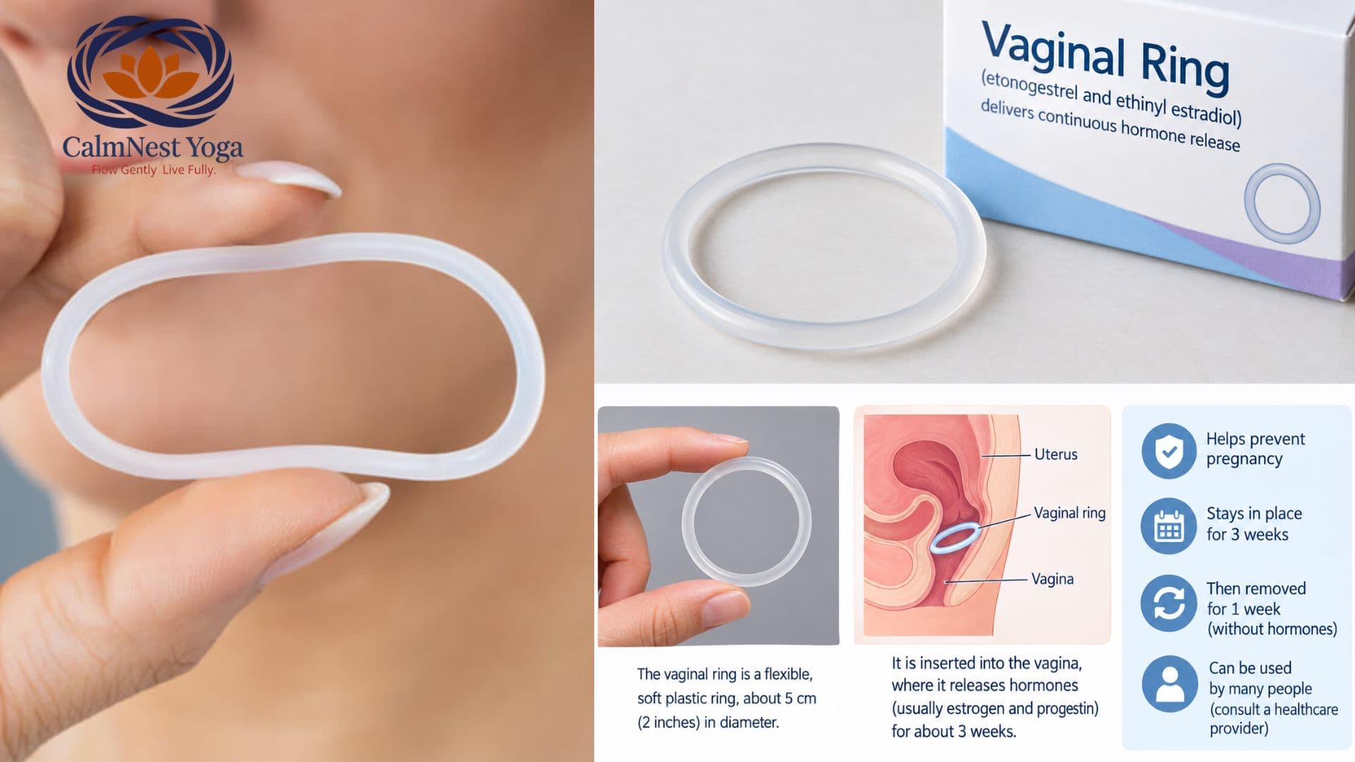 Vaginal Ring: What It Is, How It Works, Effectiveness and Usage Duration - vaginal ring